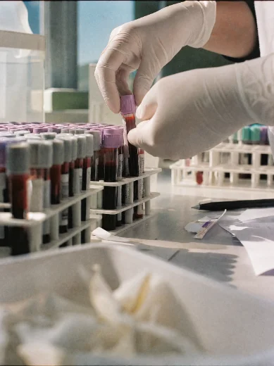 Blood samples being handled in a laboratory.